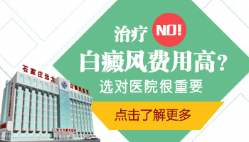 白癜风治疗费用是不是挺高的