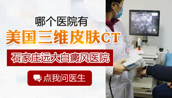 脸上有白块是什么病怎么治