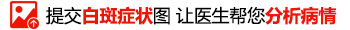 白癜风照308没发红迹象是照的时间短吗