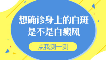 白斑边界模糊怎么确定是不是白癜风