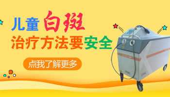 3岁小孩得了白癜风还能治好吗用什么方法治