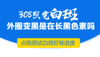 308激光治疗白癜风后的正常反应