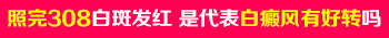 为什么照了308激光白癜风也没啥变化