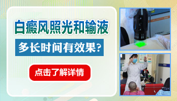 白癜风照光有什么需要注意的吗