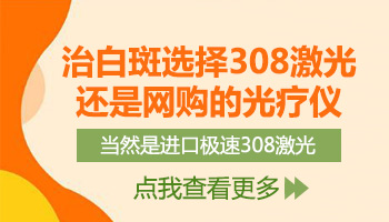 白癜风治疗仪照白斑有效果吗