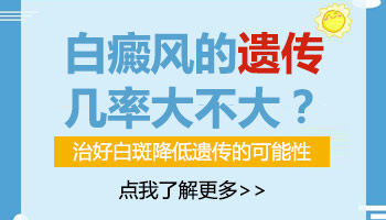 父亲有白癜风遗传给下一代的几率有多大