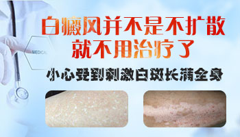 白斑如果扩散是一个月开始扩散还是半年