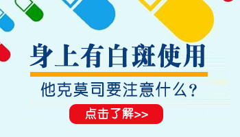 白斑为什么白天不能擦他克莫司