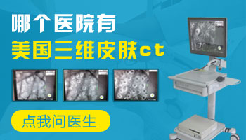 石家庄市中医院有检查白斑的皮肤ct吗
