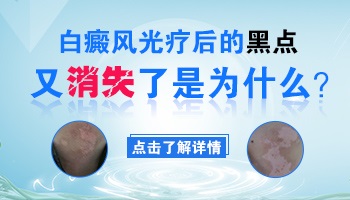 白癜风长了黑点又慢慢不见了怎么回事