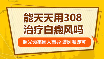 有白斑可以天天照美国308激光吗