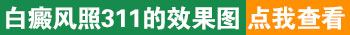 治白癜风家用308光疗仪和311哪个好