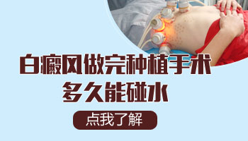 白癜风黑色素移植是多久不能碰水
