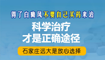 日本膏对白癜风有没有作用