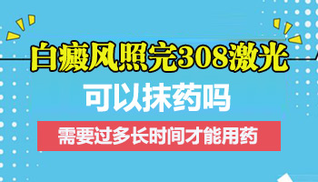 早期白斑做308光疗后还用抹药吗