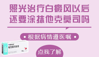 手上的白癜风照激光能治好吗