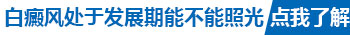 手上的白癜风照激光能治好吗