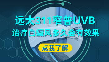 uvb紫外线照白癜风一次照30分钟可以吗