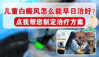 儿童头皮上的白癜风可以照光吗