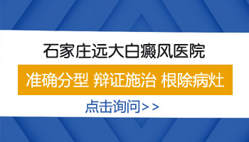 石家庄治疗白癜风怎么样 治白斑花钱多吗