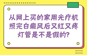 家用308激光有效果吗 半岛家用光疗仪真的有用吗