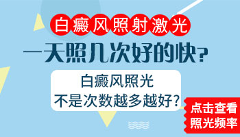 308激光治疗白癜风每天照射几次