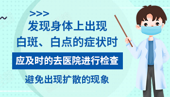 小面积的白癜风多久会变成大面积