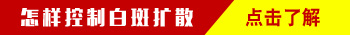 白癜风做308光疗白斑还会扩散吗