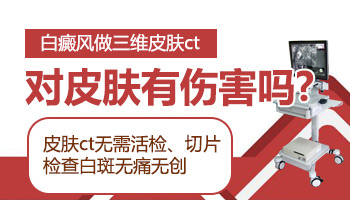 白斑做皮肤ct检查和皮肤镜检查哪个更准些