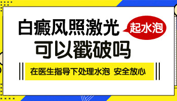 白癜风光疗后起水泡可以涂药吗