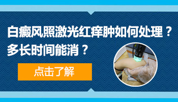 手背白点照308准分子激光后红痒好几天了怎么处理