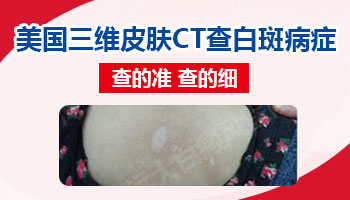脸上有白色斑块在长大是什么原因