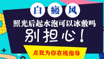 308照白癜风照过头怎么缓解 可以冰敷吗