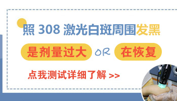 白癜风边缘明显发黑是计量大了吗