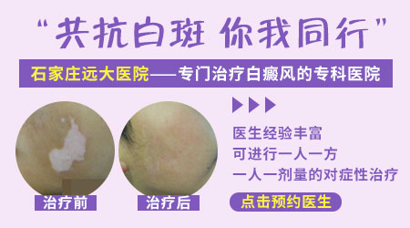 孩子患白癜风治疗后复发怎么办