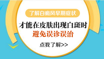 白癜风出现多长时间一般才算是早期