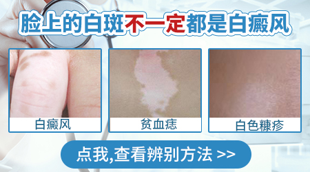 脸上出现很小的白色斑点是什么