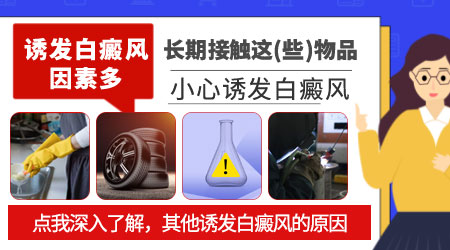 白癜风是怎么得的 得了白癜风能治好吗