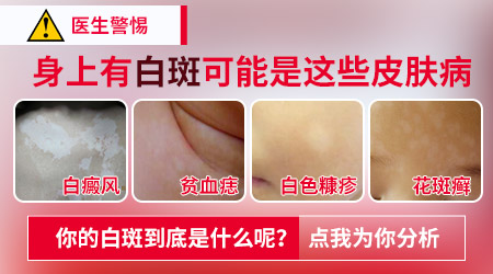 大腿内侧白斑一般是什么