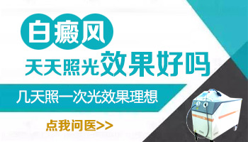 极速308激光白癜风患者能每天照射吗