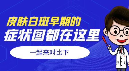 屁股上有点白不知道是不是白癜风怎么办