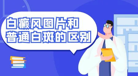 白癜风和普通白斑的区别有哪些