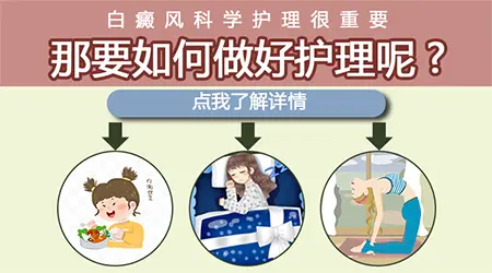 白癜风治疗几个月了白斑已经消失可以停止治疗吗