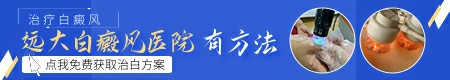 偏方治疗白癜风会越治越严重吗