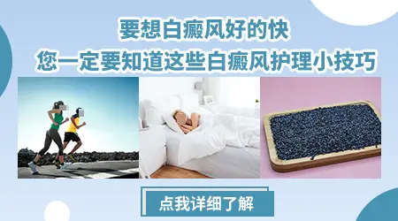 家用的308激光治疗仪多少钱一台