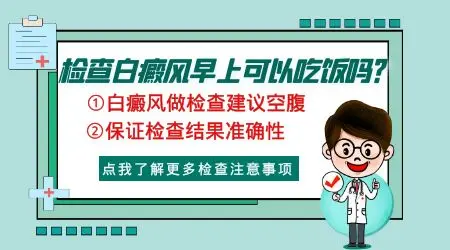 检查白癜风早上可以吃饭吗