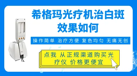 希格玛光疗机照白癜风怎么样