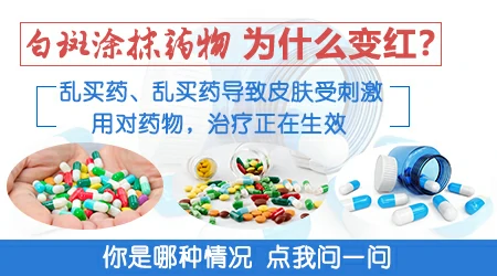 白癜风抹了两天卤米松白斑发红是不是见效了