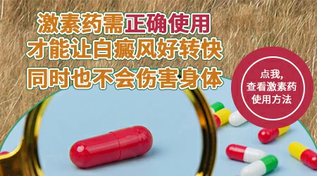 白癜风打激素针能控制住吗