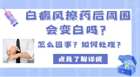 脖子上有一块白癜风腿上也有了怎么办